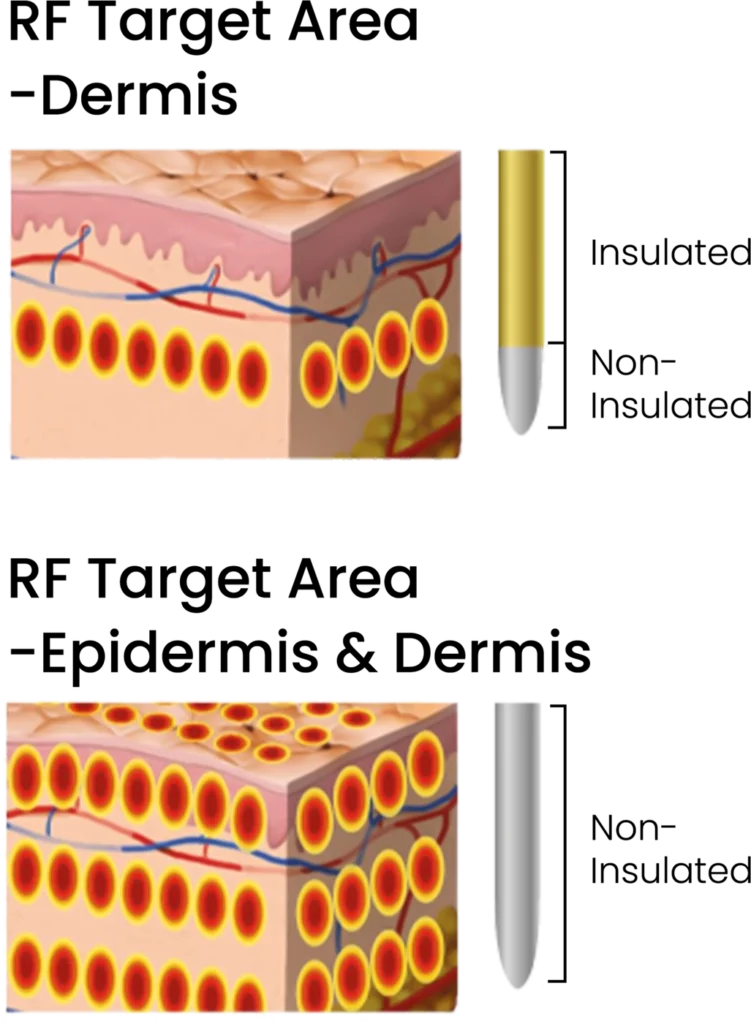 Fractional RF Target Area