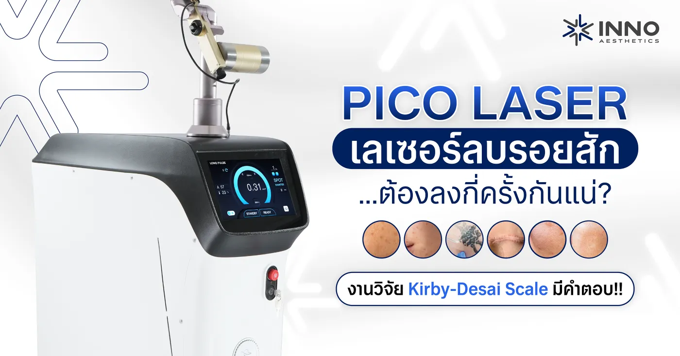 Pico Laser เลเซอร์ลบรอยสัก ต้องลบกี่ครั้งกันแน่ ? งานวิจัย Kirby-Desai Scale มีคำตอบ