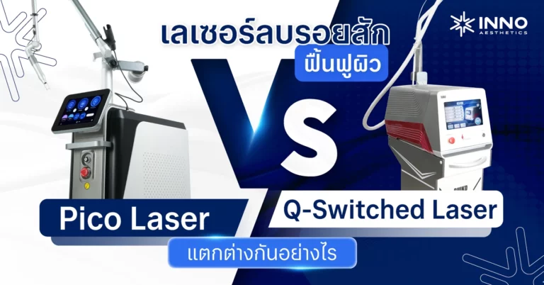 ลบรอยสักด้วย Pico Laser กับ Q-Switched ต่างกันอย่างไร ?