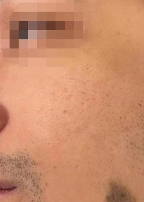 1 Review After-INNO-IMG