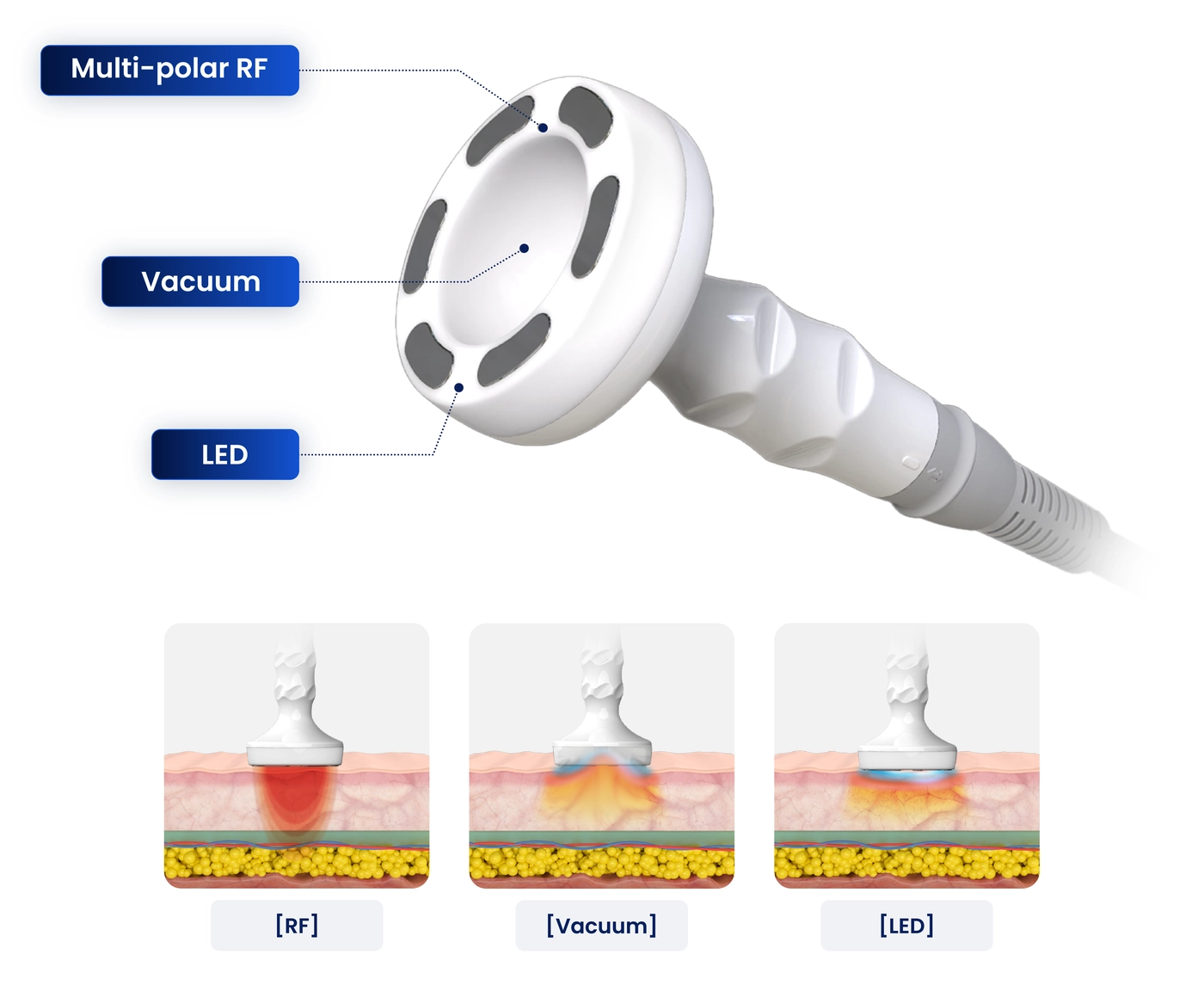 Multi-Polar RF Handpiece-n-INNO-IMG