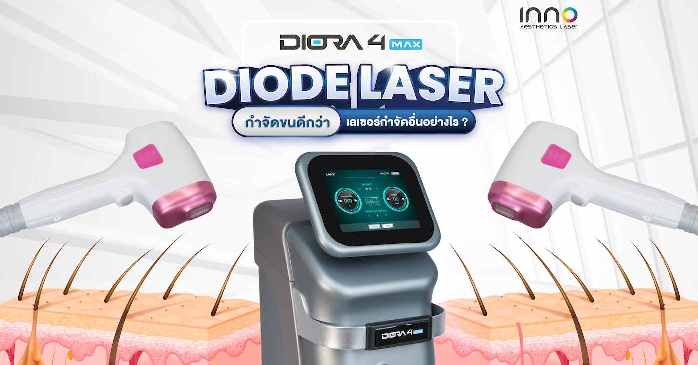 Diode Laser กำจัดขนดีกว่าเลเซอร์กำจัดอื่นอย่างไร ?