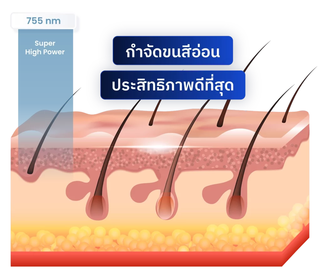 กำจัดขนอ่อน-INNO-IMG