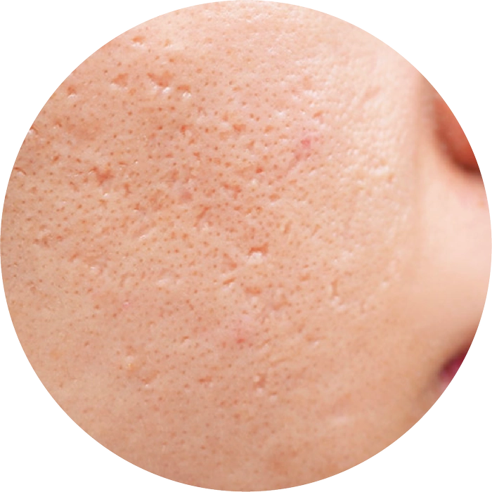 ช่วยแก้ปัญหา Ultrascan-INNO-IMG