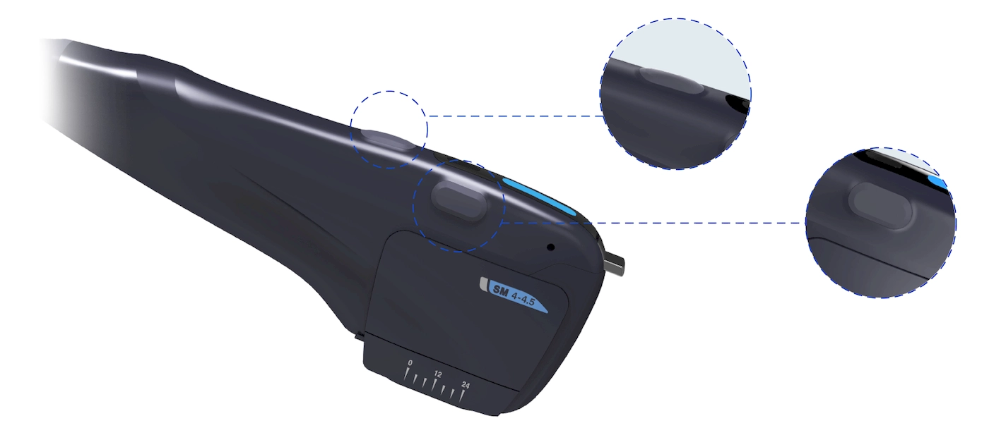 Convenient Treatment Microson