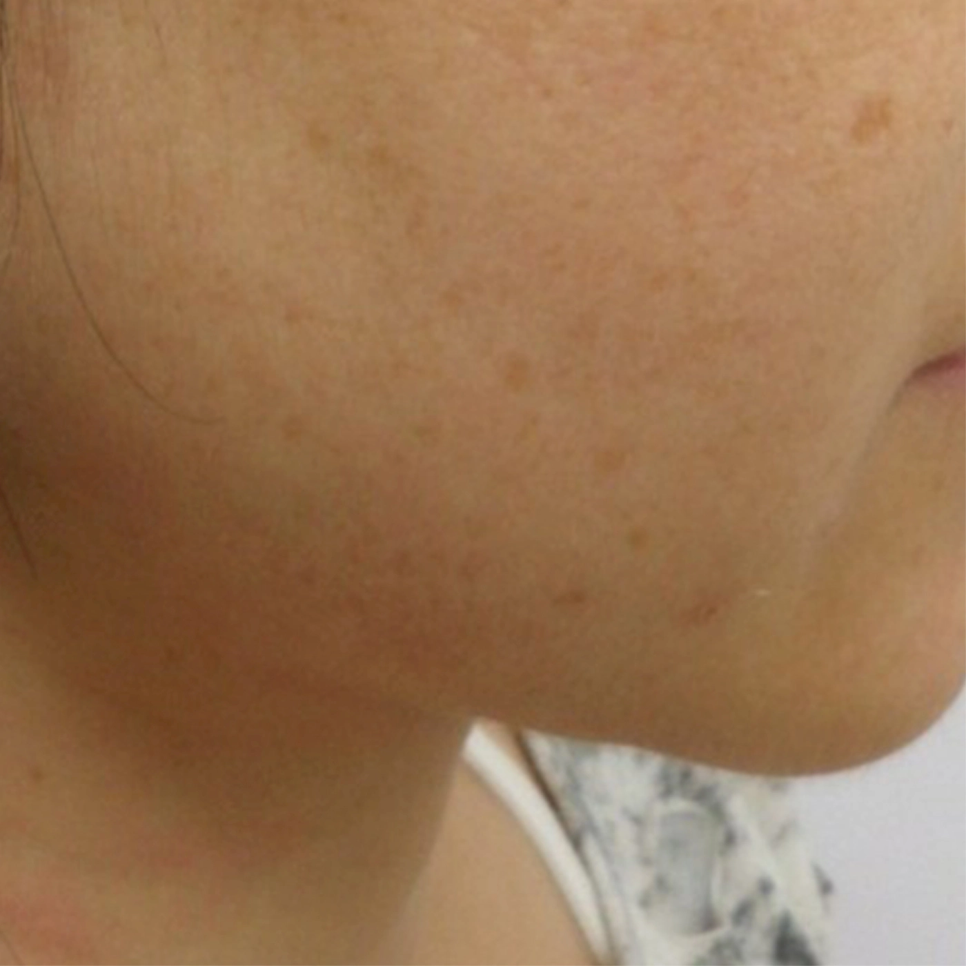 Duet RF 1-A-INNO-IMG