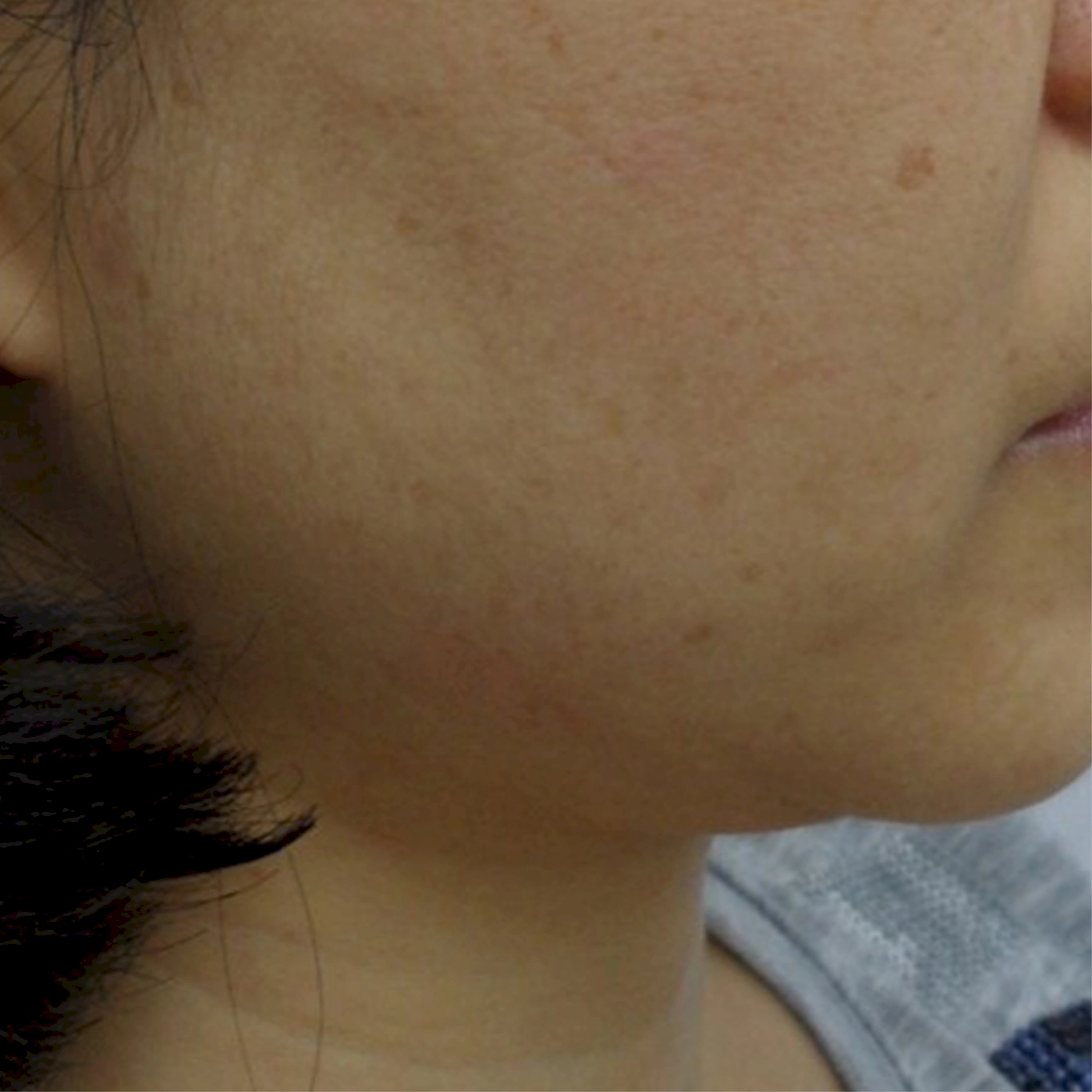 Duet RF 1-B-INNO-IMG