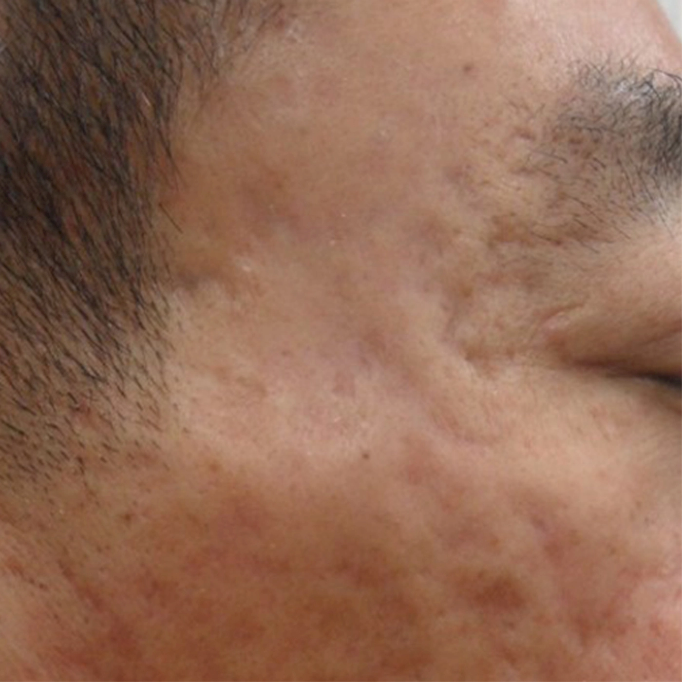 Duet RF 2-A-INNO-IMG