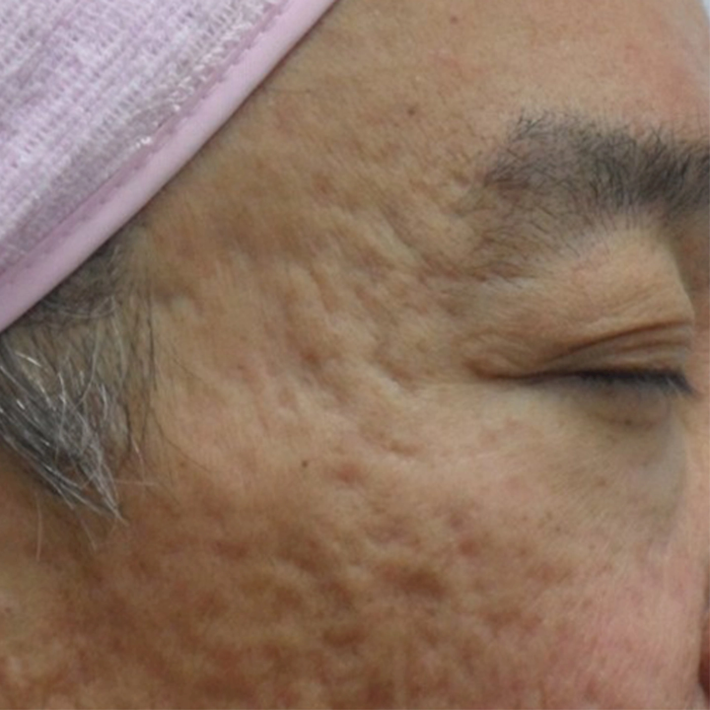 Duet RF 2-B-INNO-IMG