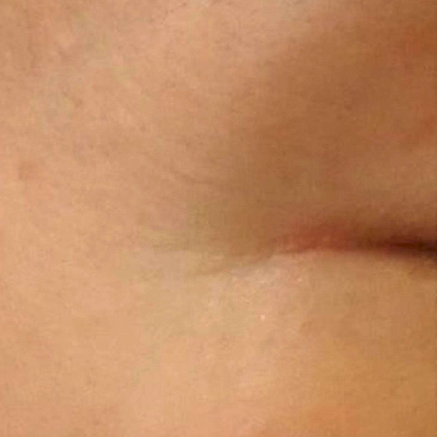 Duet RF 3-A-INNO-IMG