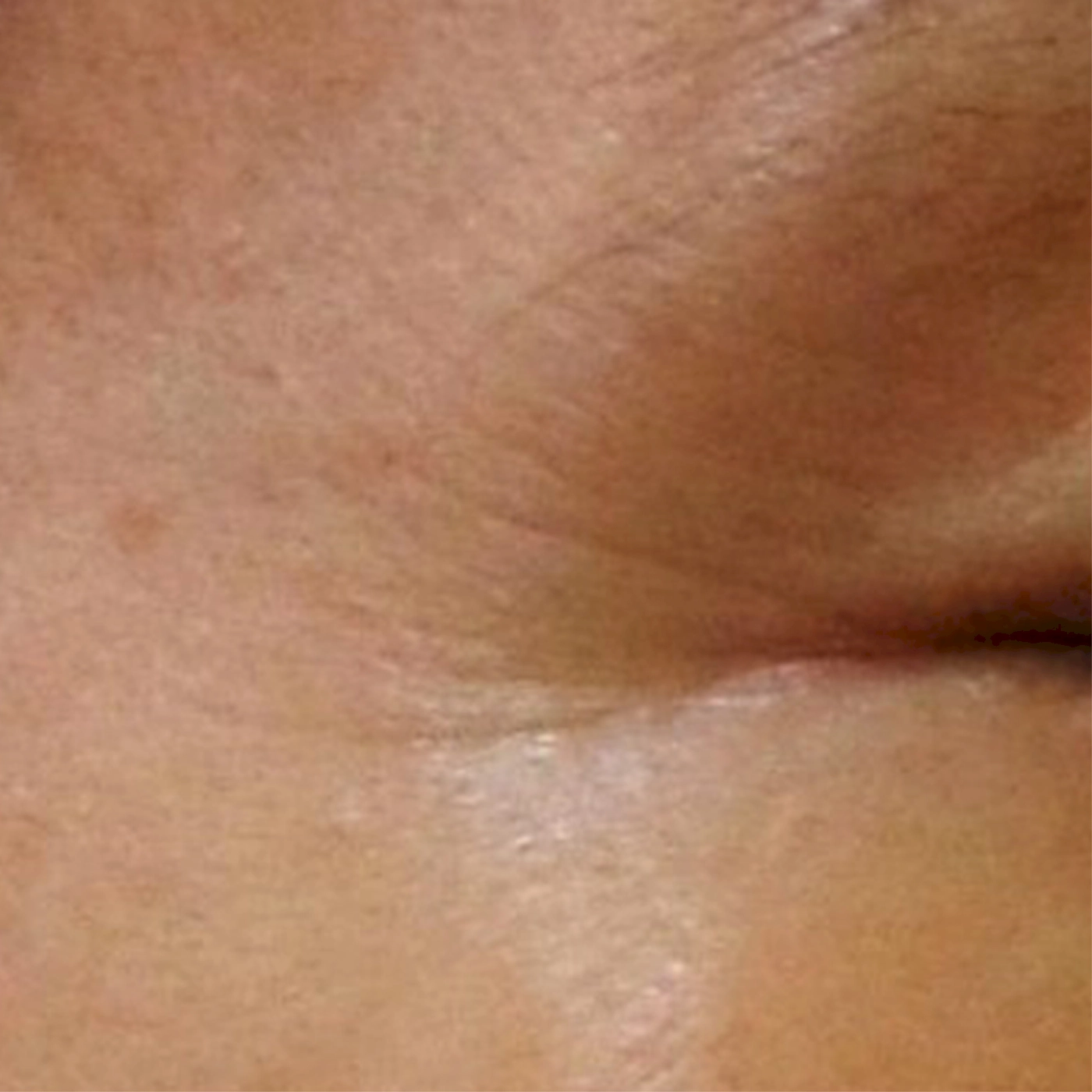 Duet RF 3-B-INNO-IMG