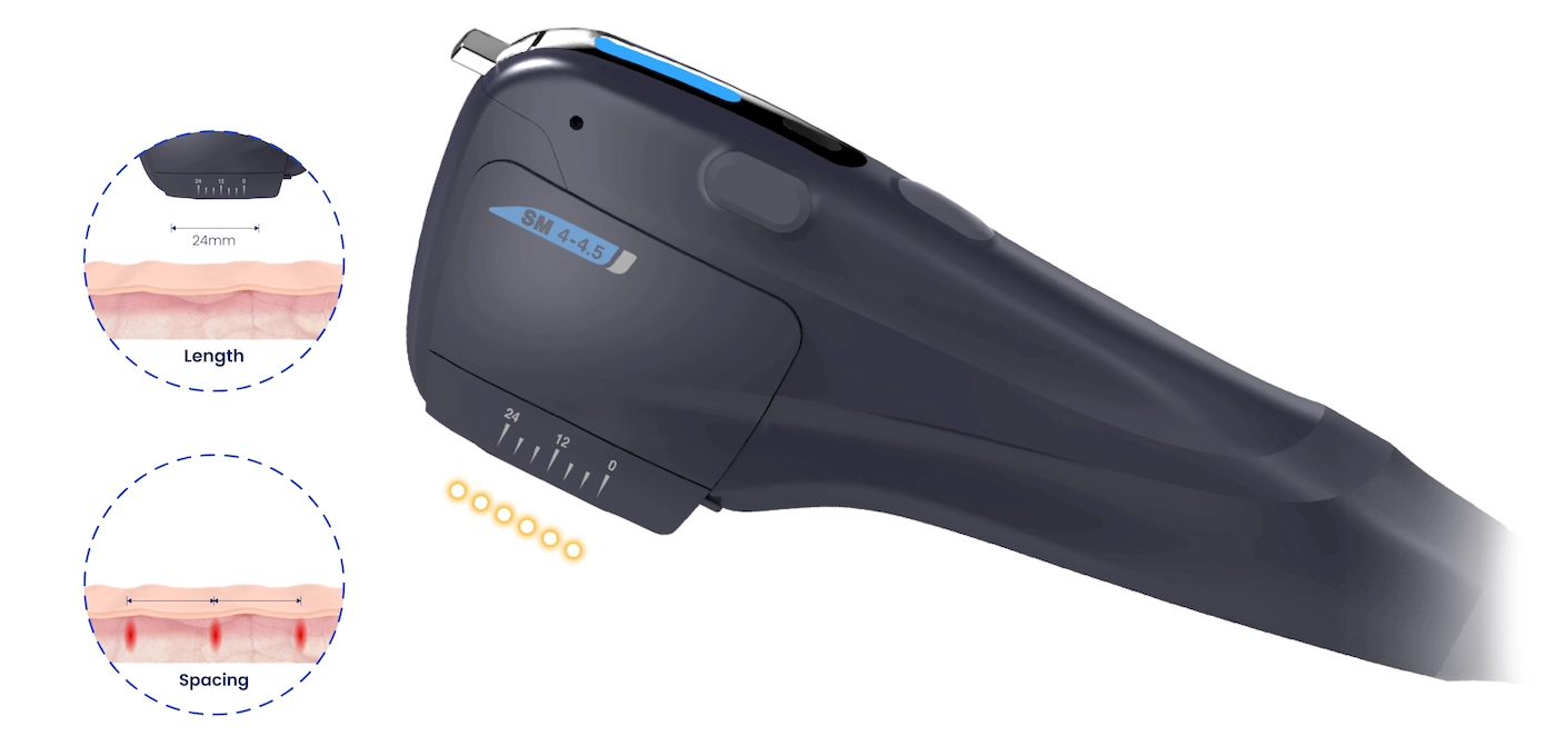 Fast Treatment Wide Range Microson