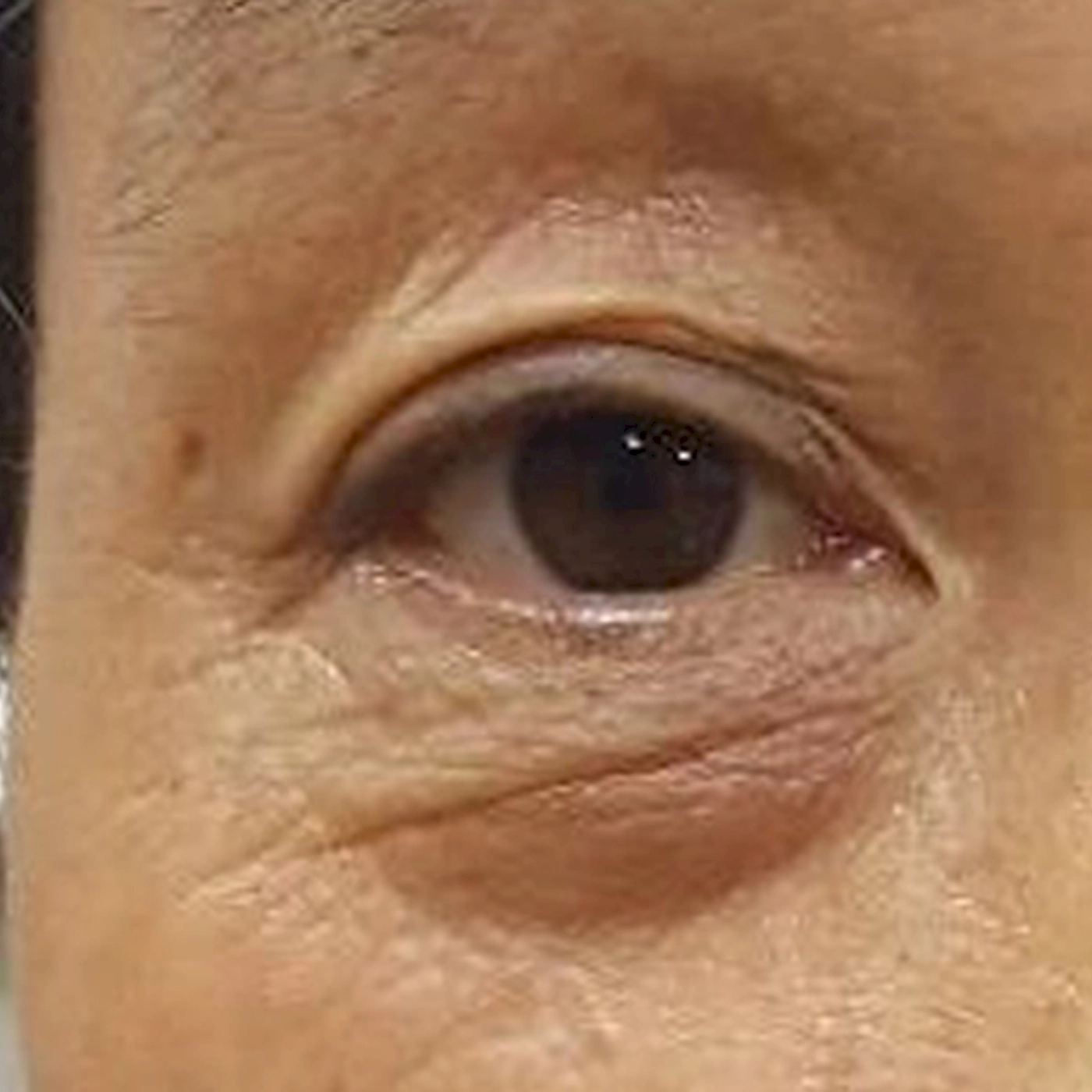 Recell 3 After-INNO-IMG