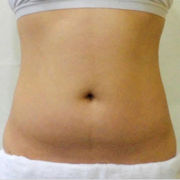 aurorax2 A1-INNO-IMG