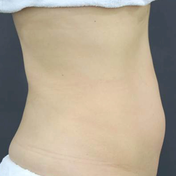 aurorax2 A2-INNO-IMG