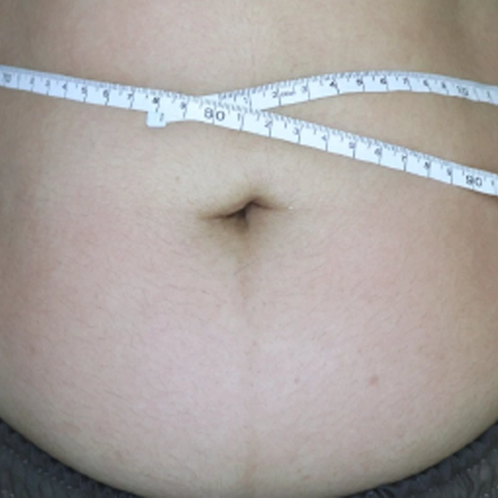 aurorax2 A3-INNO-IMG