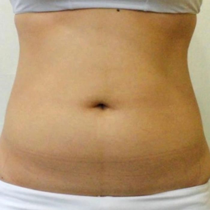 aurorax2 B1-INNO-IMG