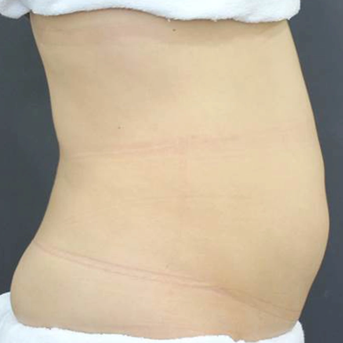 aurorax2 B2-INNO-IMG