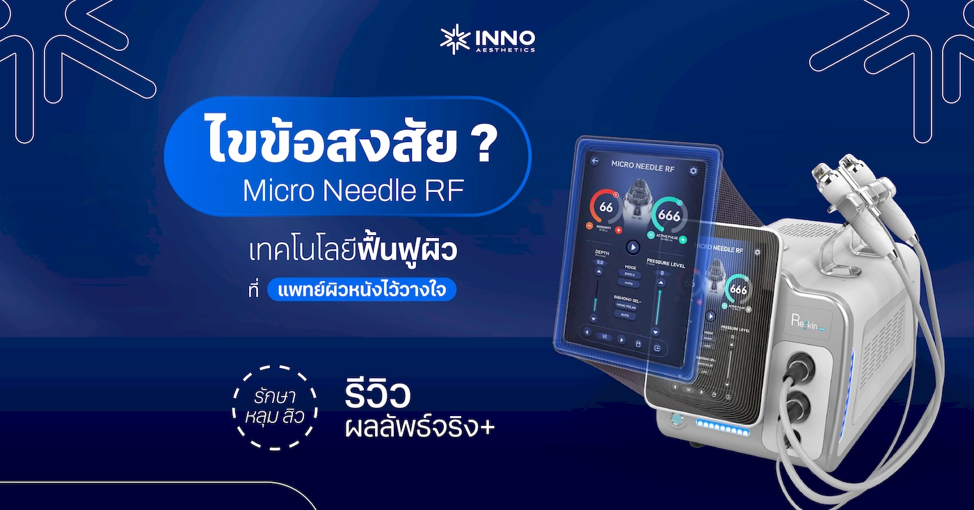 ไขข้อสงสัย Micro Needle RF เทคโนโลยีฟื้นฟูผิวที่แพทย์ผิวหนังไว้วางใจ