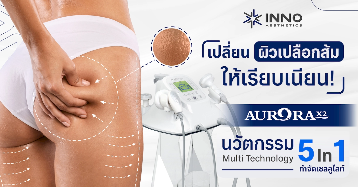 เปลี่ยนผิวเปลือกส้มให้เรียบเนียน! Aurora X2 นวัตกรรม Multi Technology 5 In 1 กำจัด เซลลูไลท์