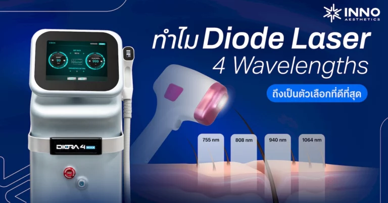 ทำไม Diode laser 4 Wavelength ถึงเป็นตัวเลือกที่ดีที่สุด