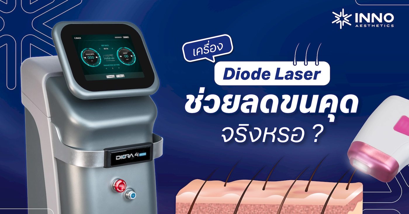 เครื่องDiode laser ช่วยลดขนคุดจริงหรอ ?