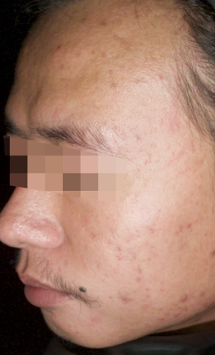 ก่อน 1BA Ultrascan-INNO-IMG