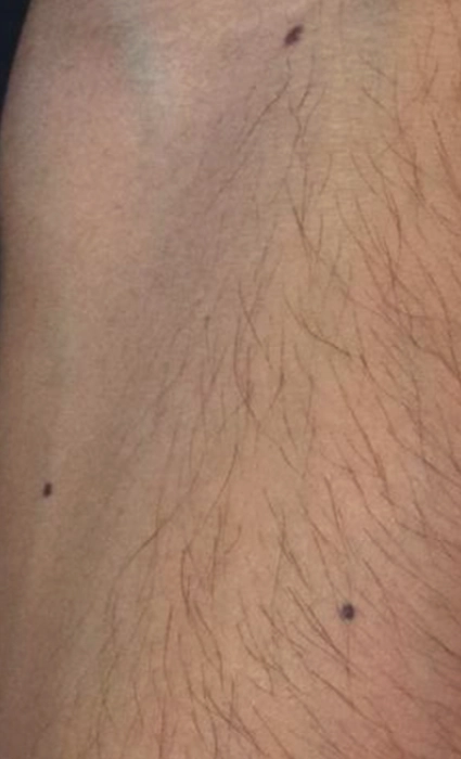 ก่อน 2BA Ultrascan-INNO-IMG