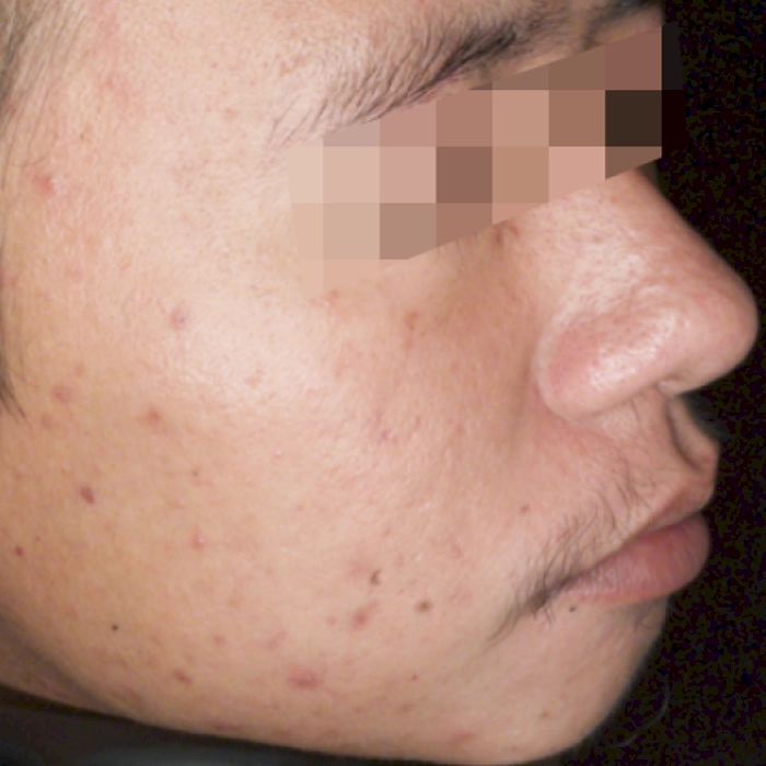 ก่อน1-BA carina-INNO-IMG