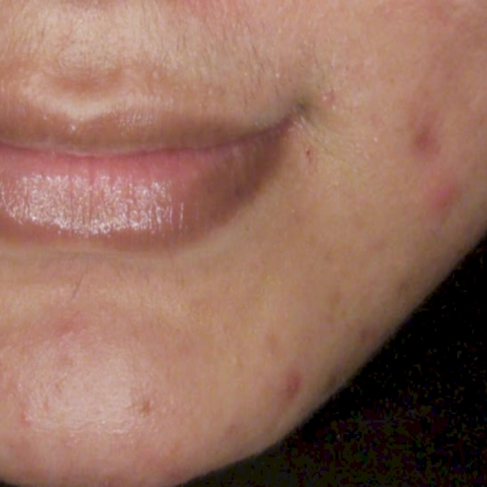 ก่อน2-BA carina-INNO-IMG