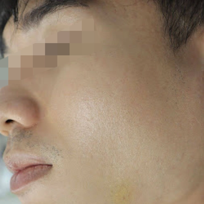 หลัง 1-BA-Vital3-INNO-IMG