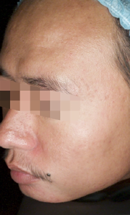 หลัง 1BA Ultrascan-INNO-IMG