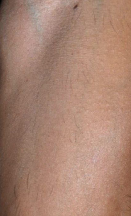 หลัง 2BA Ultrascan-INNO-IMG