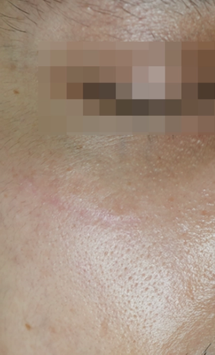 หลัง 3BA Ultrascan-INNO-IMG