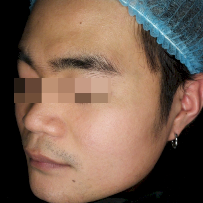 หลัง1-BA ECIO II-INNO-IMG