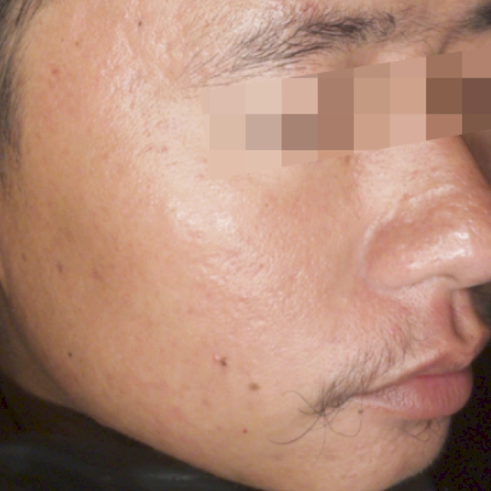 หลัง1-BA carina-INNO-IMG