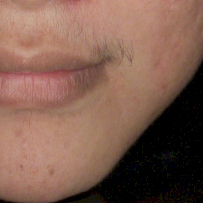 หลัง2-BA carina-INNO-IMG