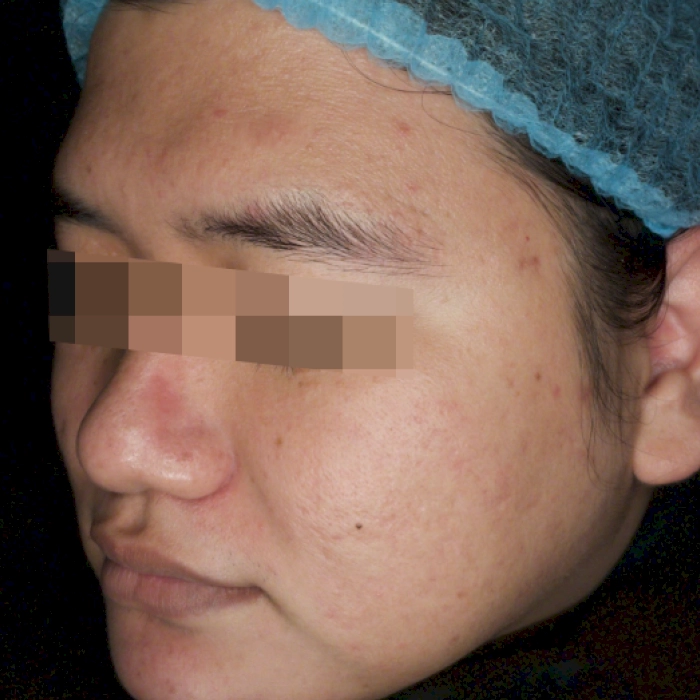 หลัง3-BA carina-INNO-IMG