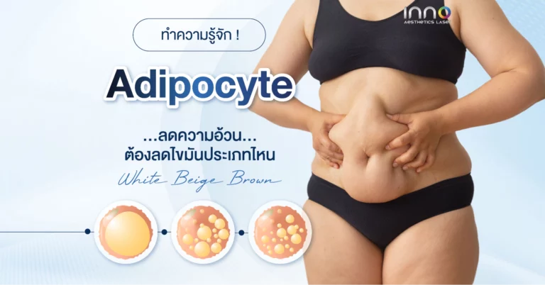 ทำความรู้จัก ! Adipocyte ลดความอ้วนต้องลดไขมันประเภทไหน