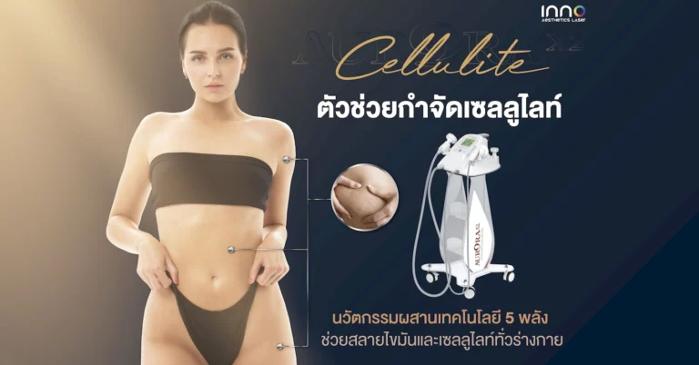 ตัวช่วยกำจัดเซลลูไลท์ นวัตกรรมผสานเทคโนโลยี 5 พลัง