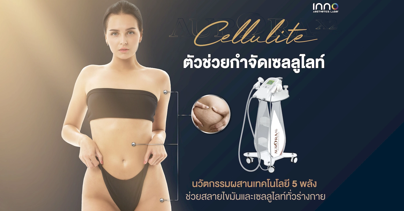ตัวช่วยกำจัดเซลลูไลท์ นวัตกรรมผสานเทคโนโลยี 5 พลัง