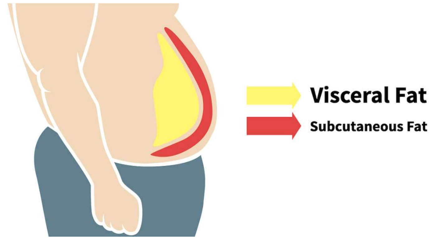 Visceral Fat