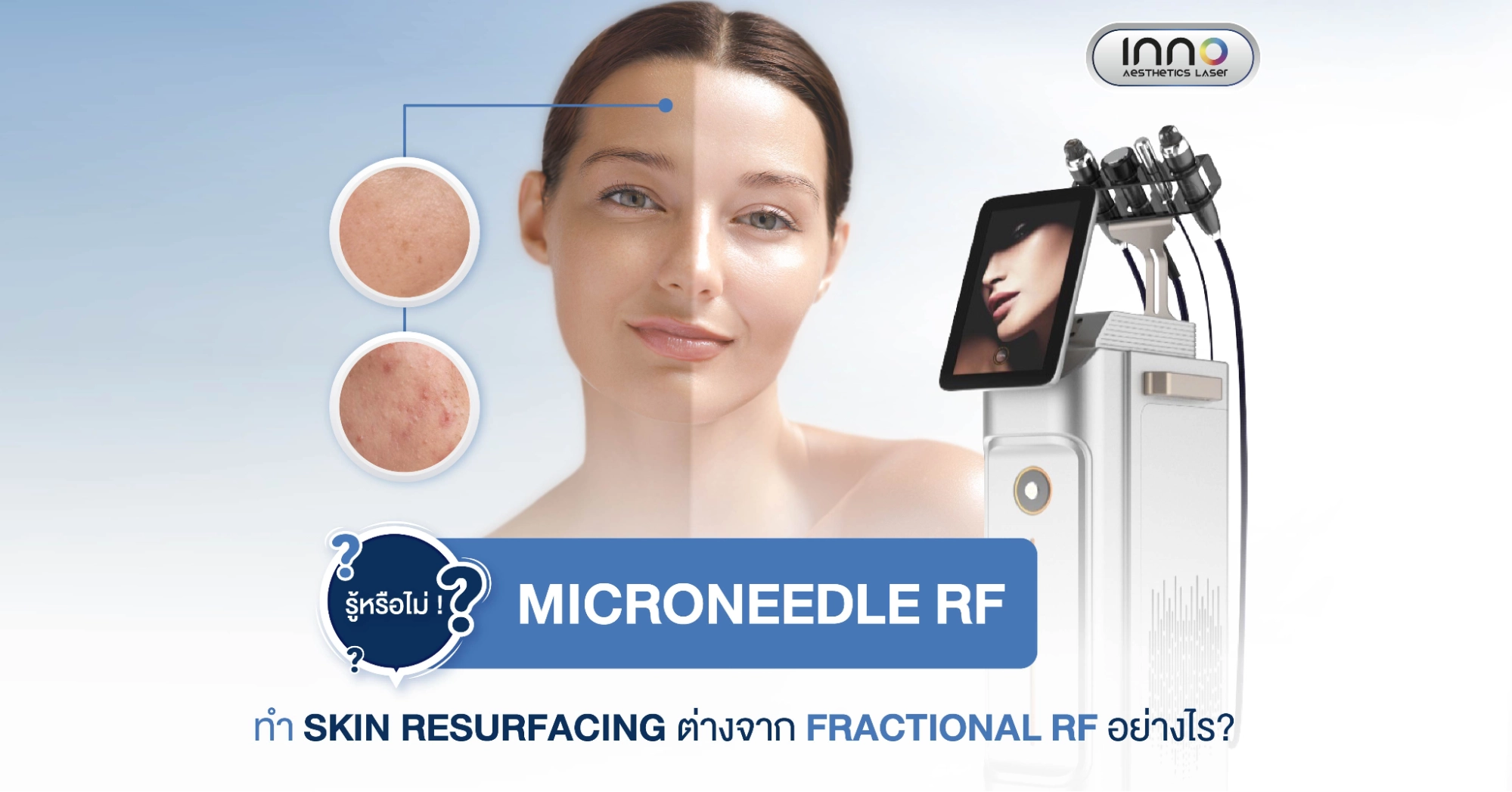 Microneedle RF ทำ Skin Resurfacing ต่างจาก Fractional RF อย่างไร?