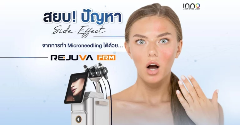 Side Effect จากการทำ Microneedling แก้ได้ด้วย Rejuva FRM