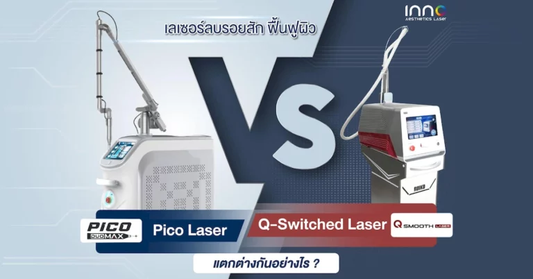 ลบรอยสักด้วย Pico Laser กับ Q-Switched ต่างกันอย่างไร ?