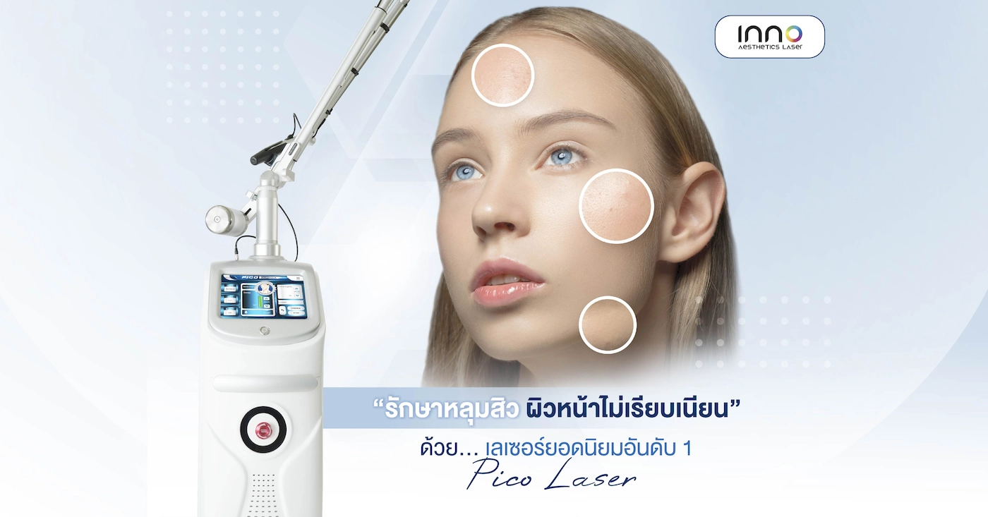 รักษาหลุมสิว ผิวหน้าไม่เรียบเนียน ด้วยเลเซอร์ยอดนิยมอันดับ 1 Pico Laser