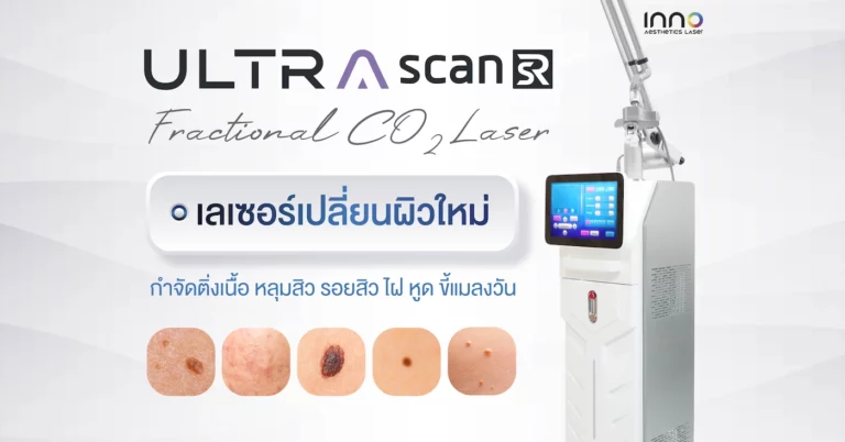 ULTRASCAN SR CO2 Laser เลเซอร์เปลี่ยนผิวใหม่ กำจัดติ่งเนื้อ รอยสิว ไฝ หูด ขี้แมลงวัน