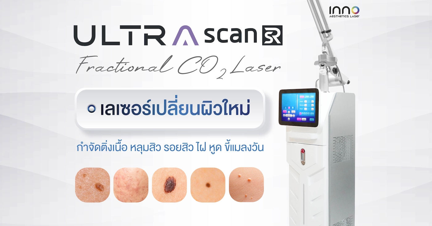 ULTRASCAN SR CO2 Laser เลเซอร์เปลี่ยนผิวใหม่ กำจัดติ่งเนื้อ รอยสิว ไฝ หูด ขี้แมลงวัน