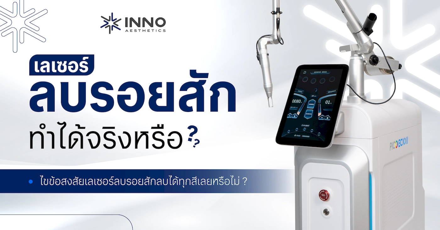 เลเซอร์ลบรอยสัก ทำได้จริงหรือ ? ไขข้อสงสัย ลบได้ทุกสีหรือไม่ !