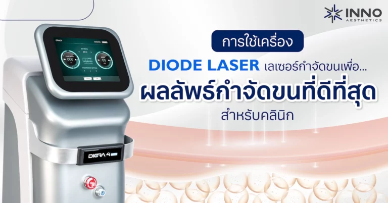 การใช้เครื่อง Diode Laser เลเซอร์กำจัดขน เพื่อผลลัพธ์กำจัดขนที่ดีที่สุดสำหรับคลินิก